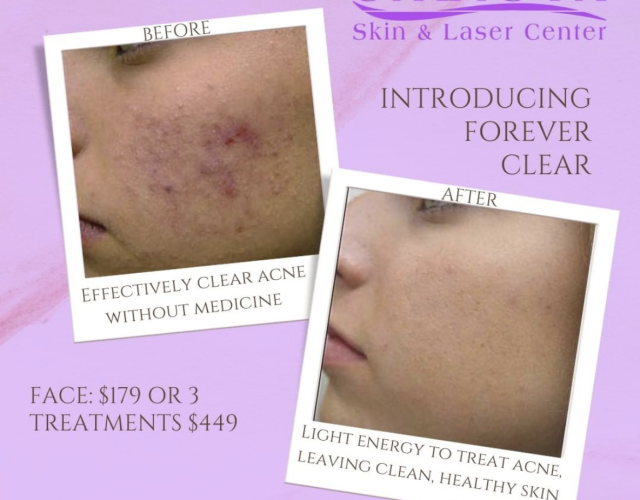 Calista Skin and Laser Center 4