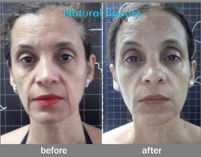 Natural Beauty Skin Club 6